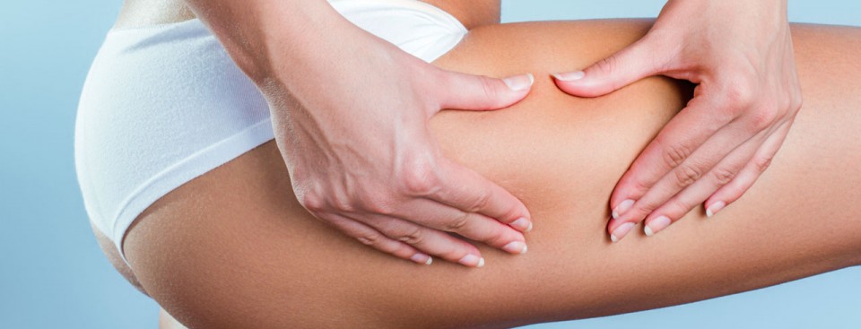 Saninforma Cellulite cosa sapere