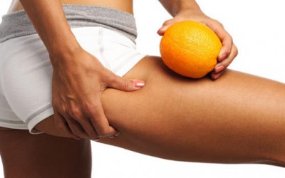 Saninforma Cellulite falsi miti