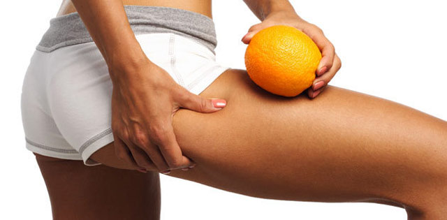 Saninforma Cellulite falsi miti